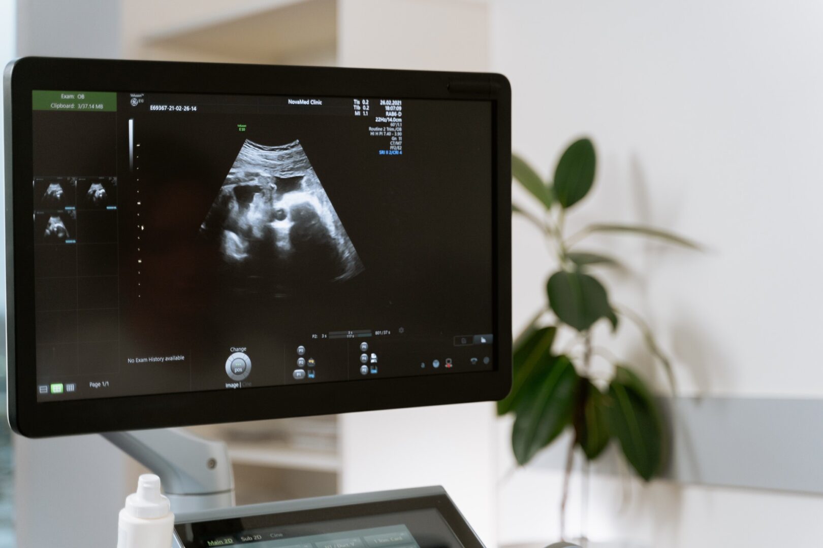 Modern ultrasound scanner machine