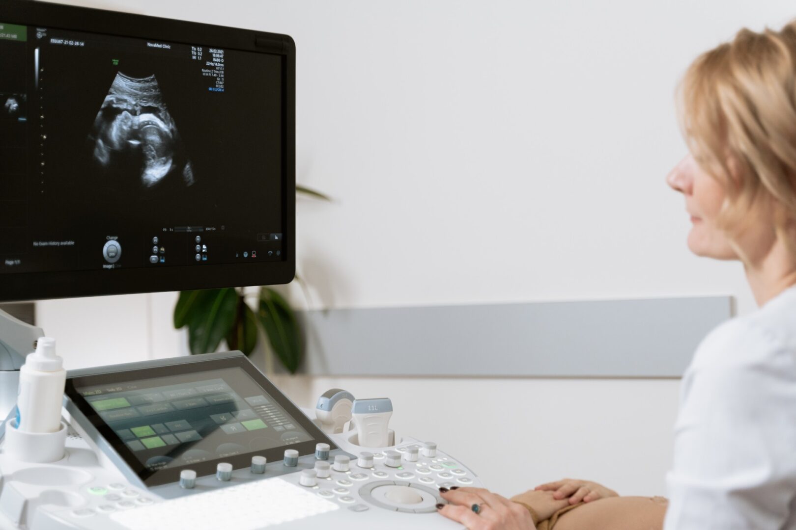Professional woman doctor sonographer working on modern ultrasound scanner